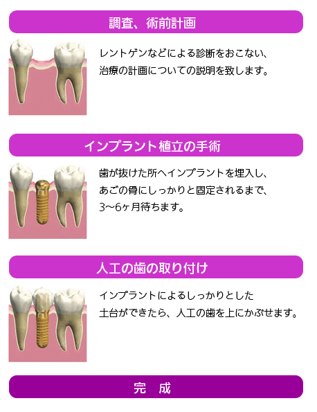 インプラント治療の流れ